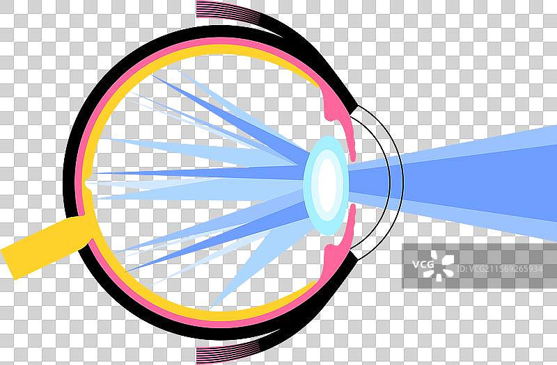 白内障眼病图片素材