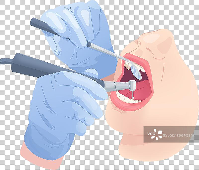 牙医的手在进行牙齿手术时使用钻头图片素材