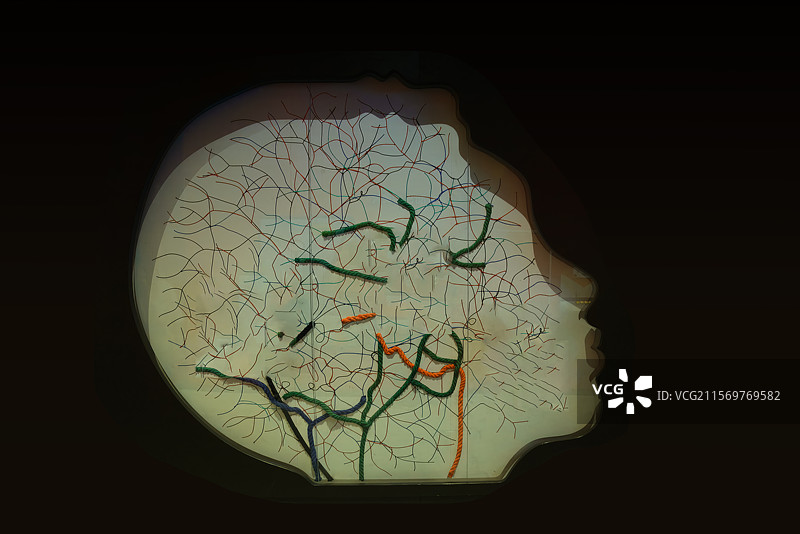 科技插图，生理，大脑解剖图，抑郁示意图图片素材