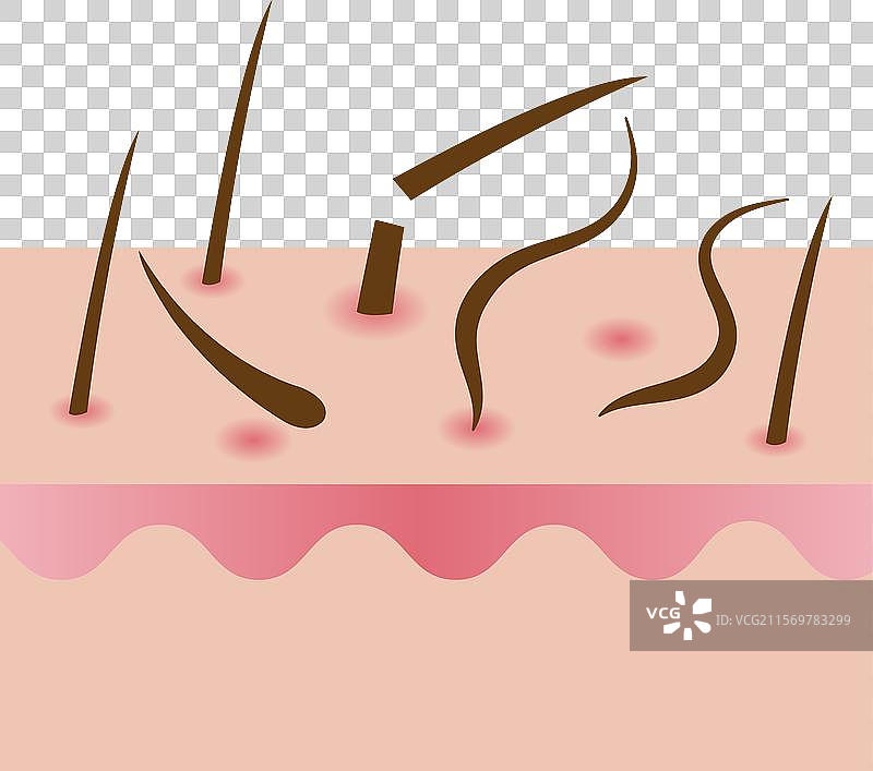 脱发与头皮层图片素材