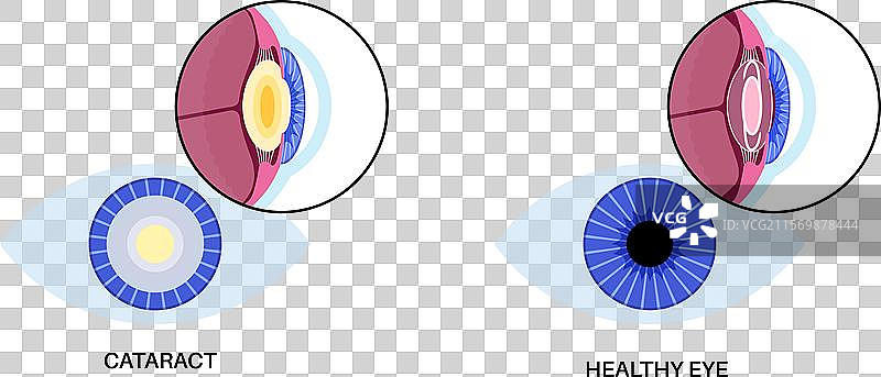 眼内镜海报图片素材