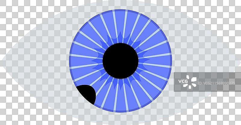 虹膜黑色素瘤解剖学图片素材