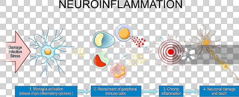 神经炎症图片素材