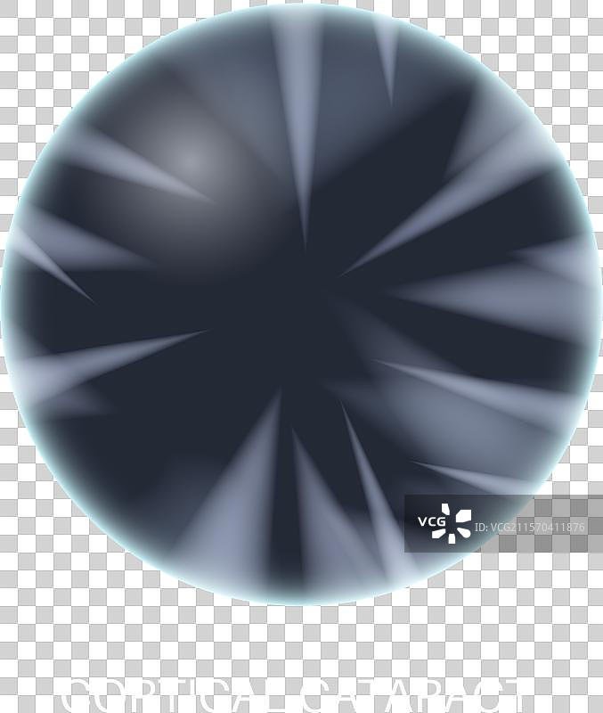 白内障眼病图片素材