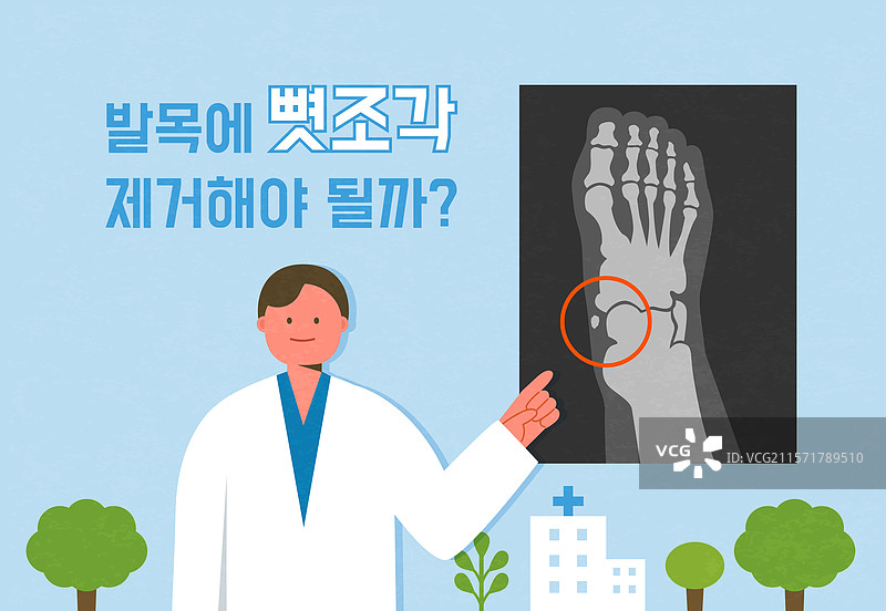 骨科，骨科医生，脚踝，韧带，扭伤，骨折，分解，X光图像，指向图片素材