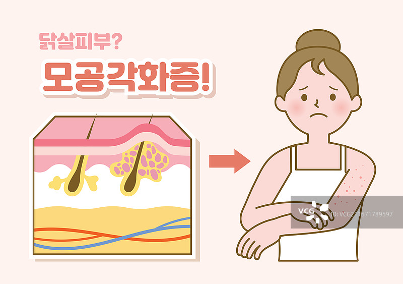 人类皮肤，夏季，毛孔，毛周角化症，角质层，毛囊图片素材