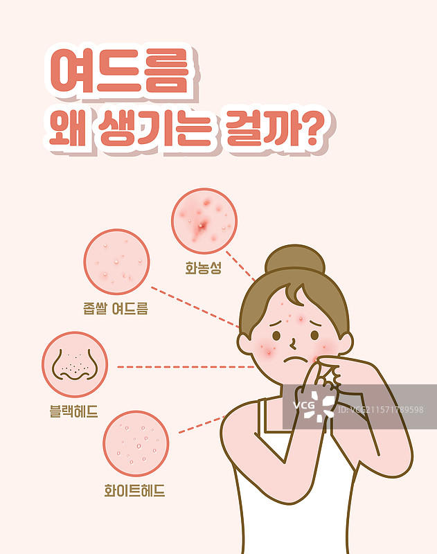 人类皮肤，夏季，护肤，皮肤科，痤疮，脓疱，黑头图片素材