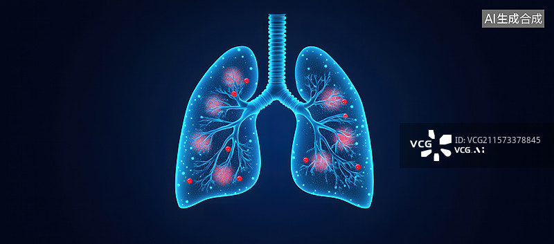 【AI数字艺术】肺部感染的医学影像图片素材