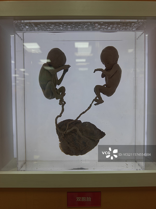 国家自然博物馆存放在玻璃容器中的人类双胞胎婴儿胚胎图片素材