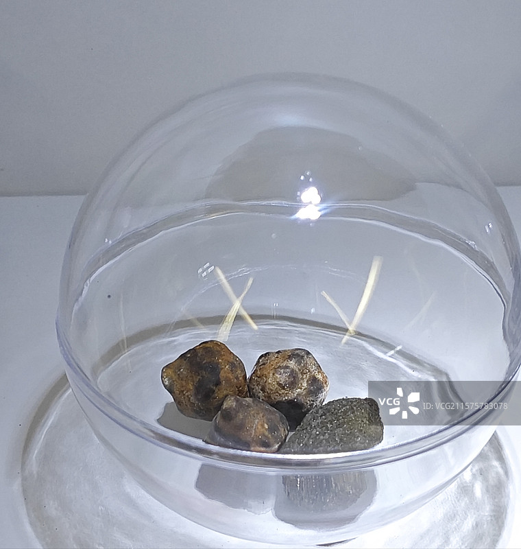 肾结石的结石展示图片素材