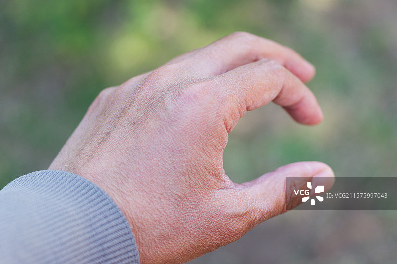 户外男人的手特写镜头，干燥皮肤成年，纹理质地衰老，人类身体，健康疾病时间图片素材