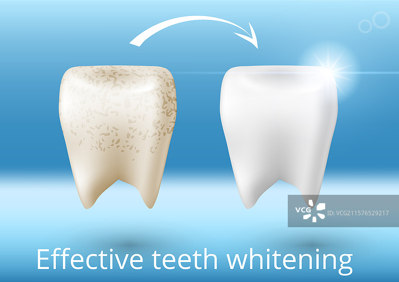牙齿美白前后的3D海报图片素材