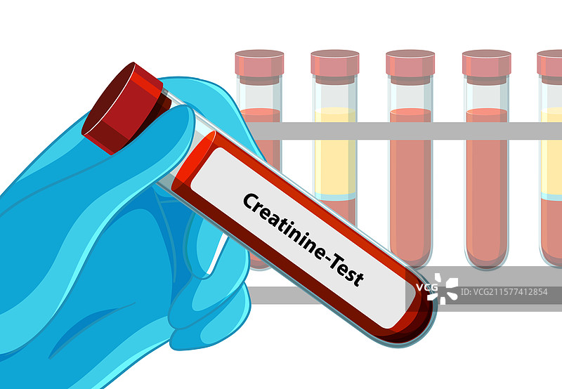 戴手套的手握着肌酐测试管图片素材