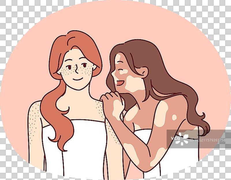 有白癜风综合症的女性在浴室里拥抱朋友图片素材