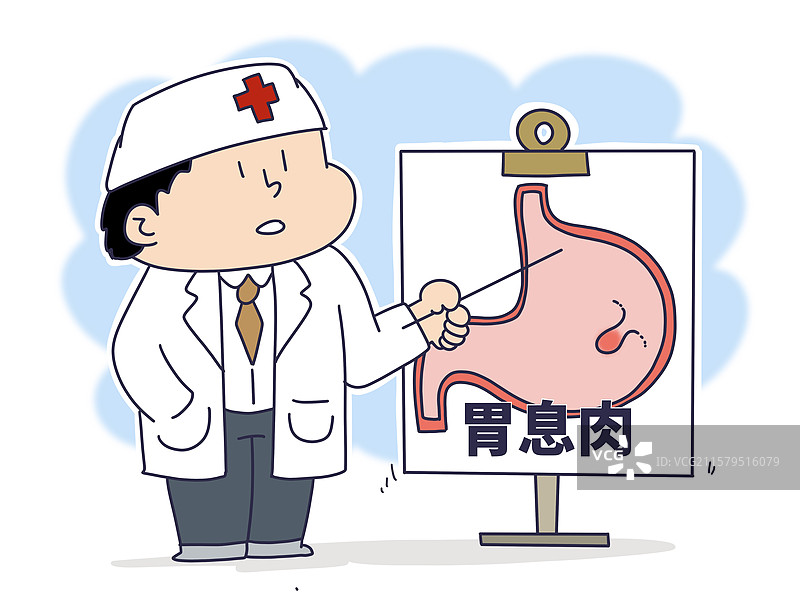 胃息肉，胃部消化系统疾病图片素材