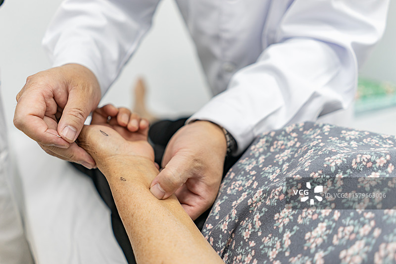 中国中医药服务拍摄主题，中医医院医生正在给病人患者后手臂手部腿部针灸治疗，室内无人图像摄影图片素材