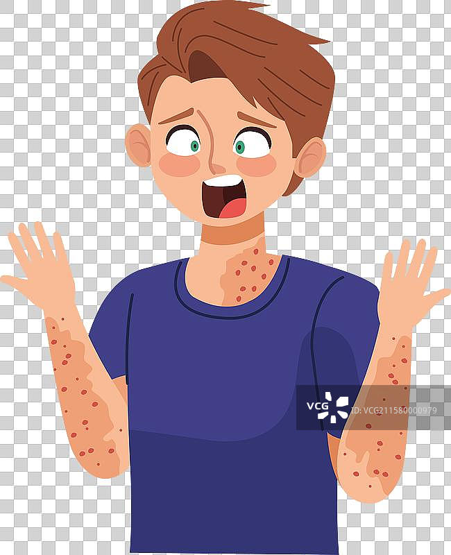 感染猴痘的男性患者图片素材