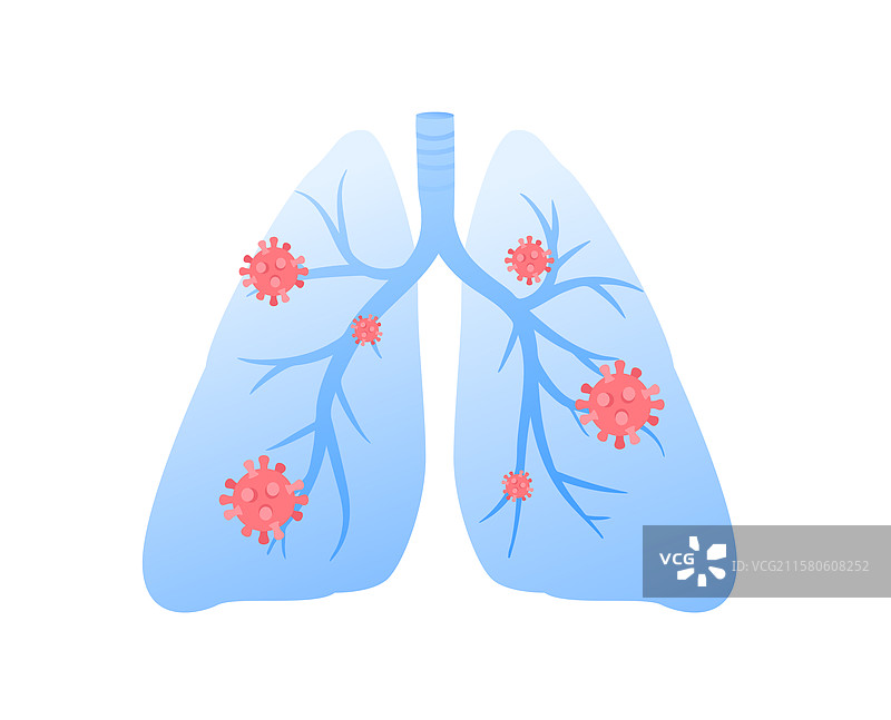 流感疫情病毒肺炎感冒肺气肿毒性流感图片素材