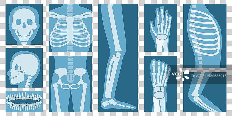 3D等距平面的人体X光图集图片素材
