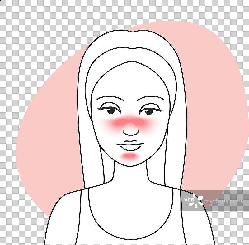 带有红斑痤疮的女性肖像与粉色背景图片素材