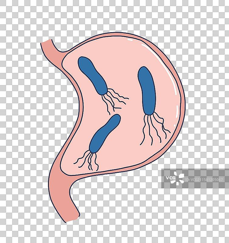 幽门螺杆菌图片素材
