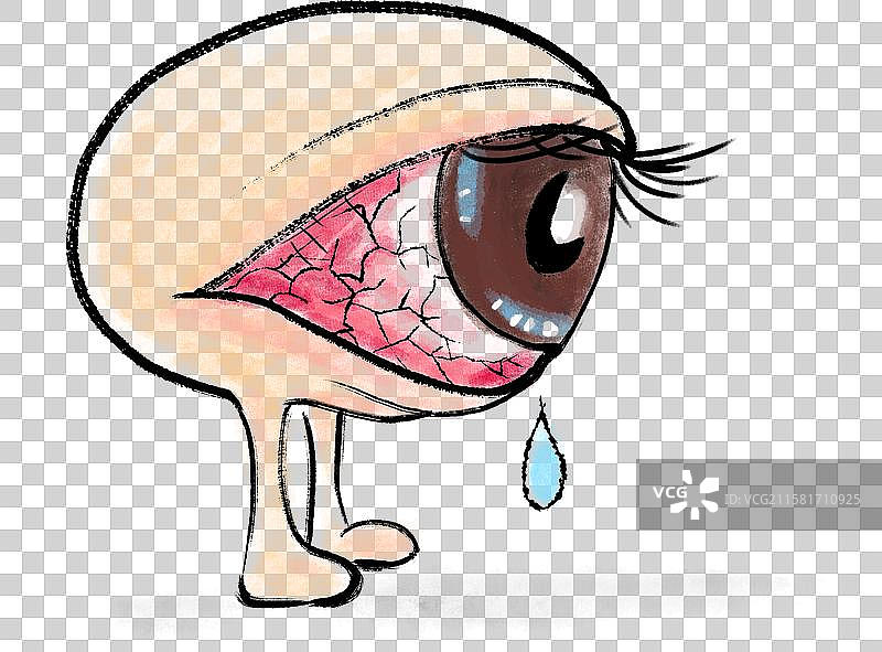 用眼过度导致的红眼病图片素材