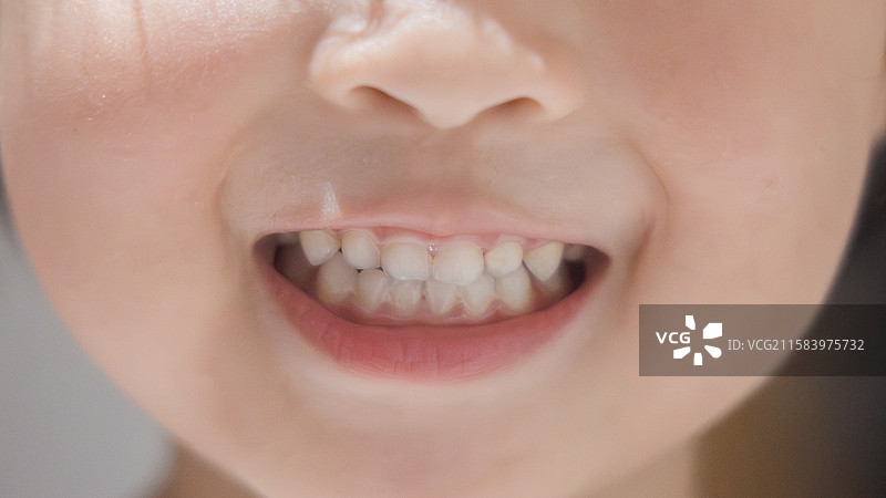儿童爱护牙齿图片素材
