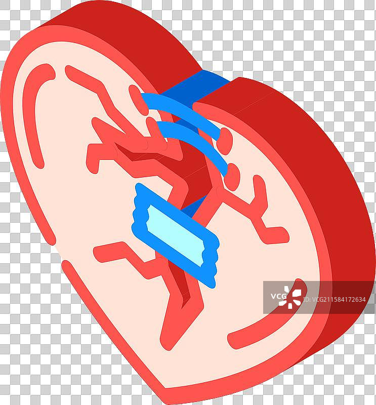 破碎心脏的等距图标图片素材