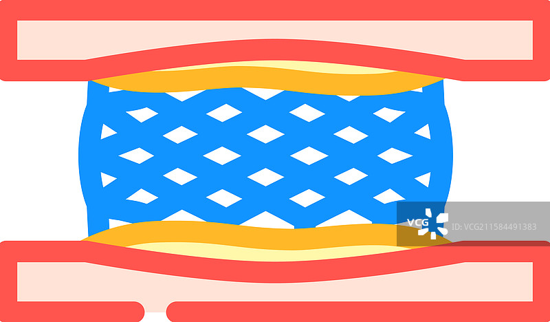 冠状动脉支架 心脏病学 彩色图标图片素材