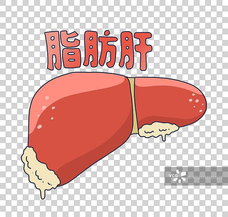 脂肪肝患者病人图片素材