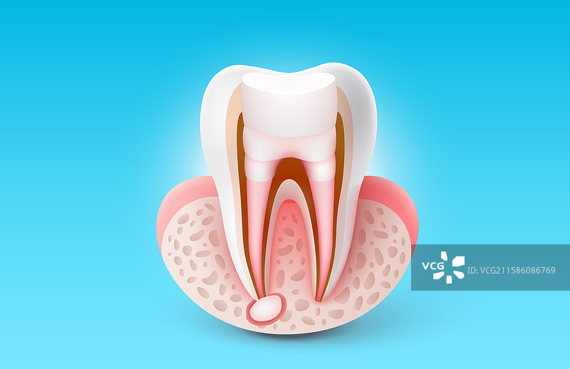 牙齿保护与牙根治疗图片素材