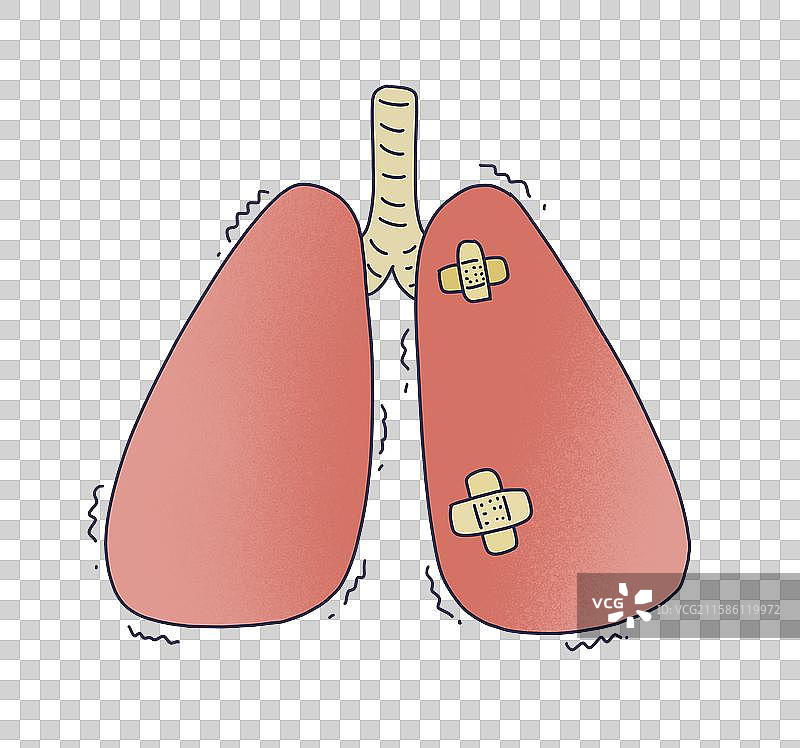 肺炎，肺部感染图片素材