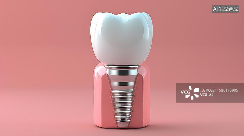 【AI数字艺术】牙齿种植修复的微观世界 健康牙齿的植入过程  牙齿种植的3D渲染模型图  种植牙假牙补牙概念图图片素材