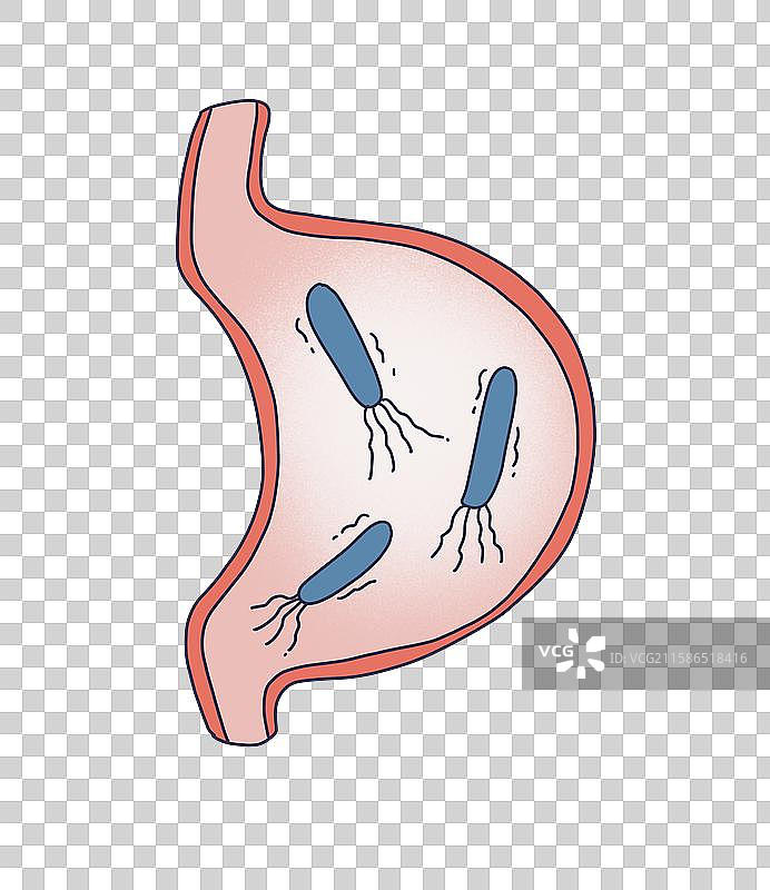 幽门螺旋杆菌，幽门螺杆菌图片素材