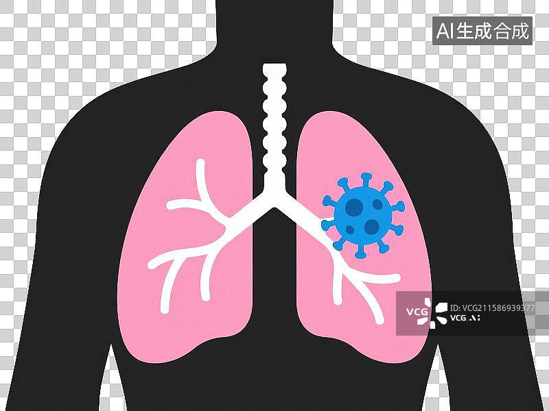 【AI数字艺术】3D渲染免抠图形元素人体肺部器官感染病毒图片素材