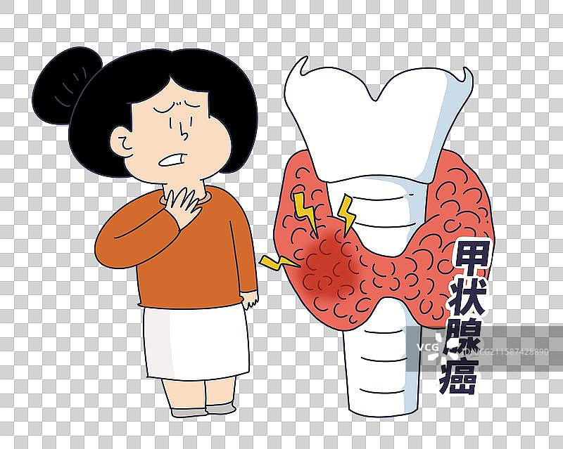 甲状腺癌患者病人图片素材