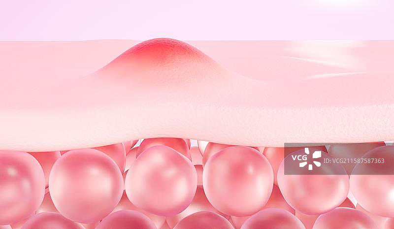 3D立体元素背景医疗健康保健医院痘痘长痘青春期痤疮图片素材