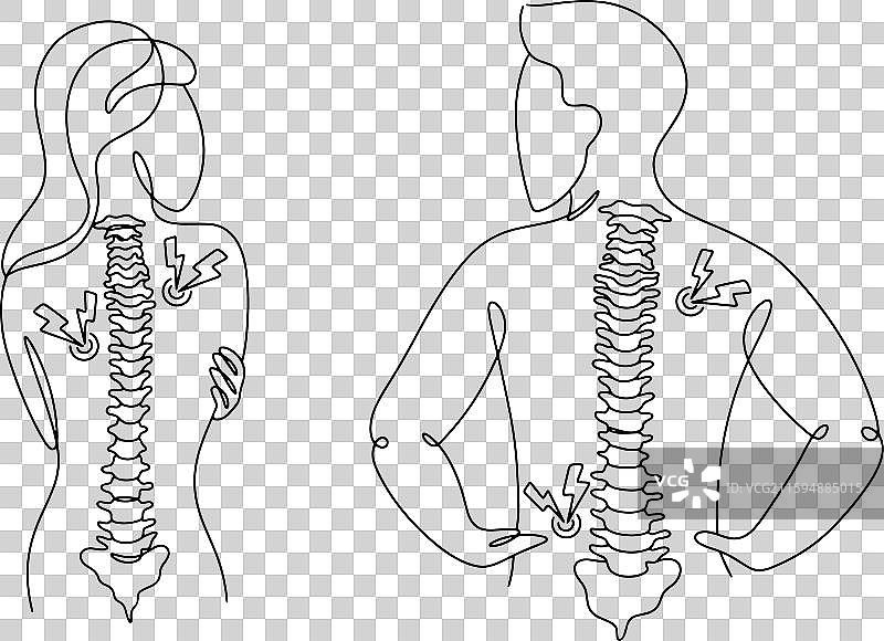 椎体骨软骨炎图片素材