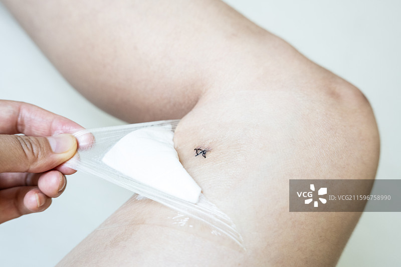 给术后缝合伤口贴无菌透明敷贴图片素材