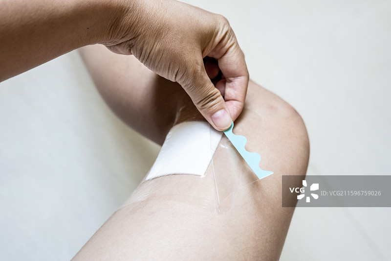 给术后缝合伤口贴无菌透明敷贴图片素材