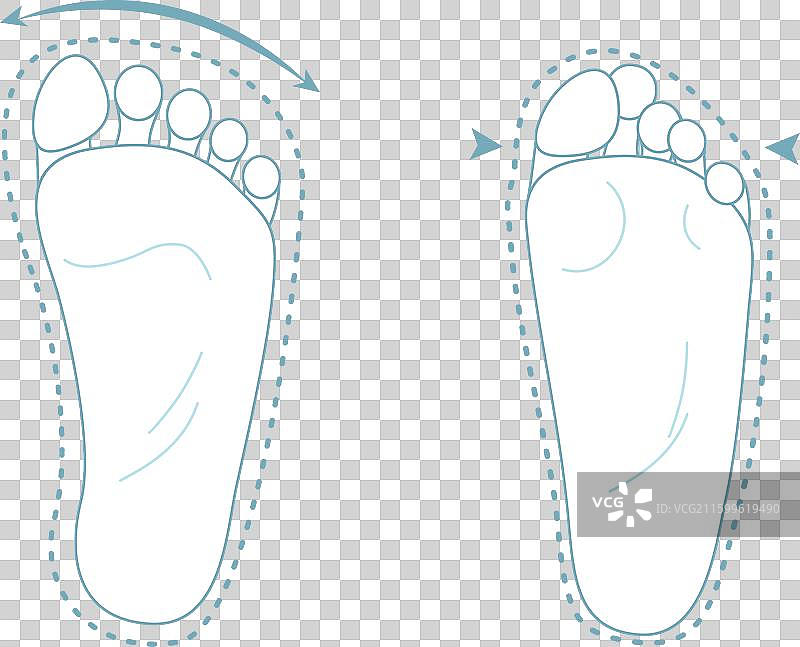 健康与畸形的人类足部对比图片素材