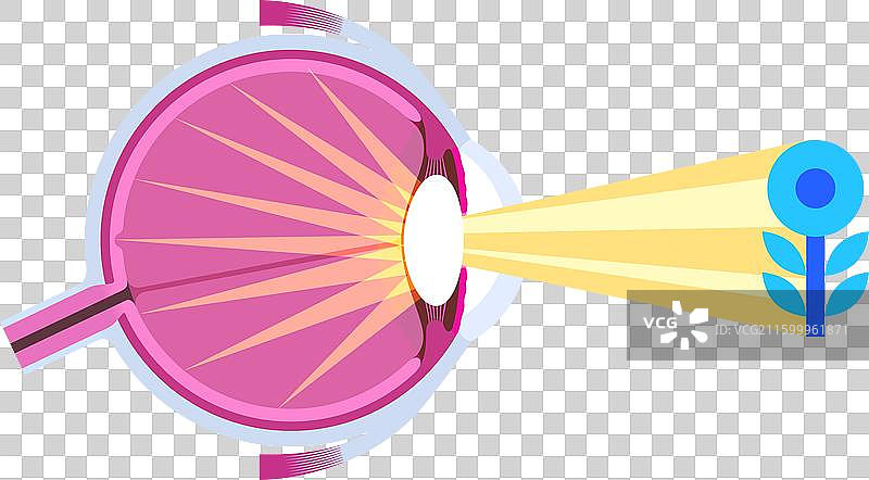 白内障眼疾图片素材