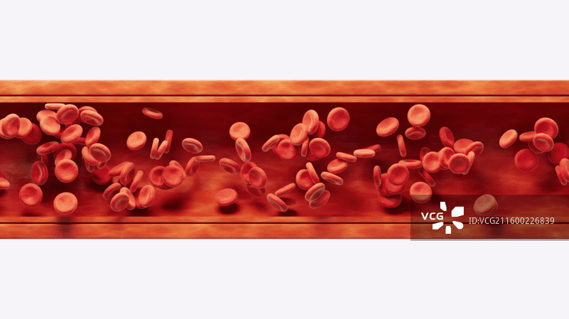 血管中的脂肪和血栓三维渲染图片素材