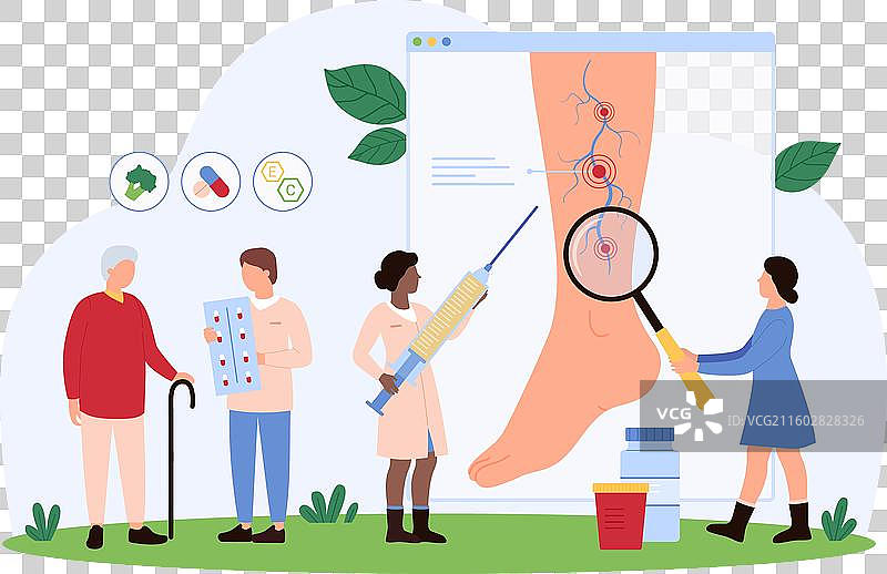 静脉曲张的诊断与治疗图片素材