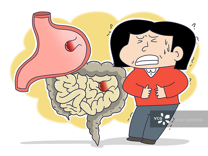 胃息肉，肠息肉，消化系统，息肉图片素材