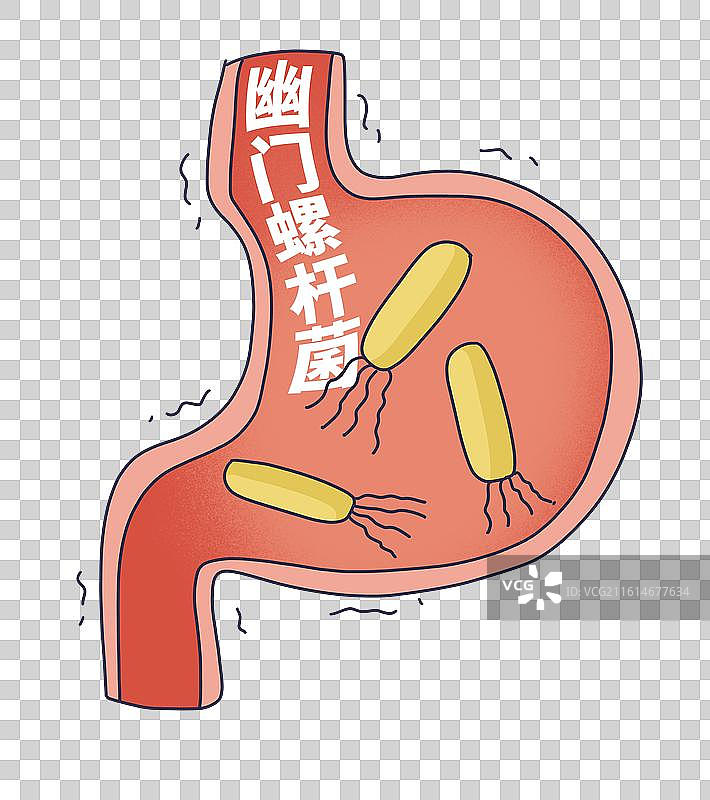 幽门螺杆菌，幽门螺旋杆菌图片素材