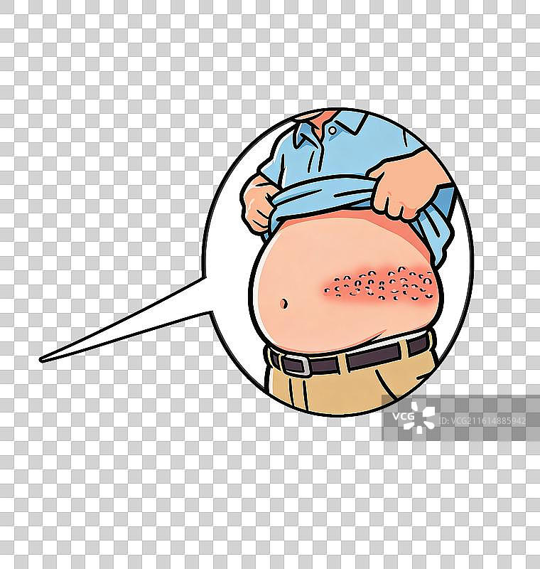 带状疱疹“腰缠龙”图片素材