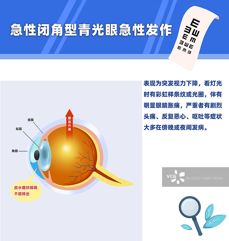 眼部疾病青光眼科普海报图片素材
