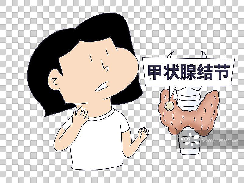 甲状腺结节图片素材