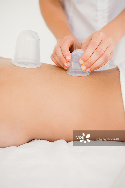 在水疗中心背部拔罐的女人图片素材